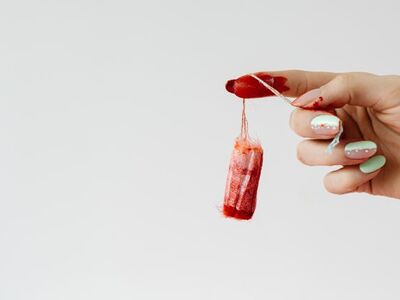 Što napraviti ako menstruacija postane preobilna?